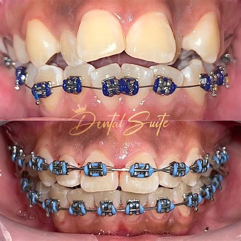 dental clinic in tacloban|Dental Suite, PCBG Bldg. Brgy. 1&4, A. Mabini Street, Tacloban .